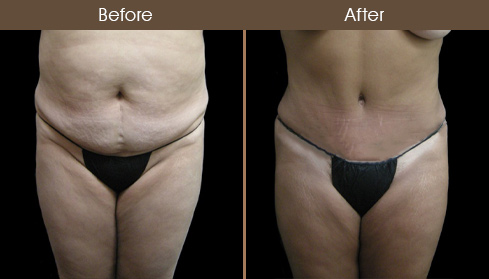 20202705152850_B18-Front